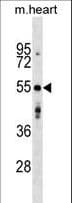AGPAT9 / MAG1 Antibody (aa194-222)