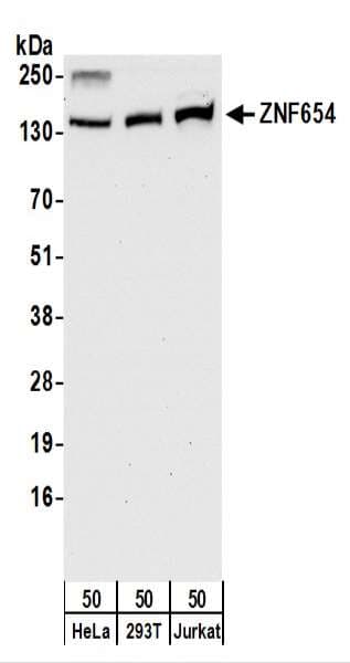 ZNF654 Antibody (aa477-527)