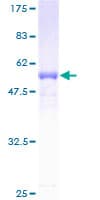 Human RDHE2 / SDR16C5 Protein (Recombinant GST)