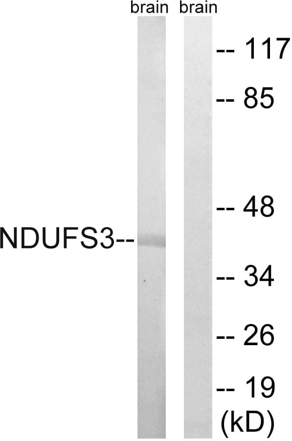 NDUFS3 Antibody (aa117-166)