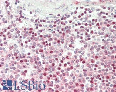 IHC-plus™ RENT1 / UPF1 Antibody (aa1079-1129)