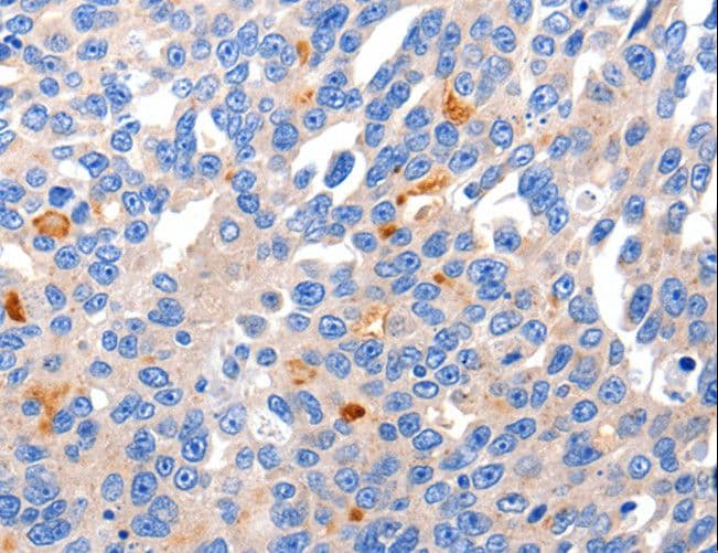 Polyclonal Rabbit anti-Human KCNH8 / ELK Antibody (IHC)