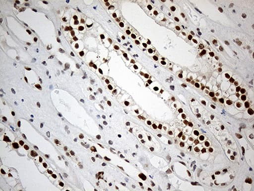 Monoclonal Mouse anti-Human RB1 / Retinoblastoma / RB Antibody (clone OTI11C10, aa309-590, IHC, WB)