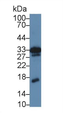 MDK / Midkine Antibody (aa22-140)