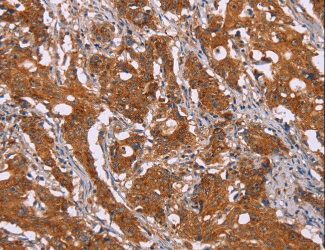 DCTN6 / Dynactin 6 Antibody