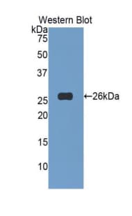 TNFSF14 / LIGHT Antibody (aa62-240)