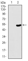 Monoclonal Mouse anti-Human TP53BP1 / 53BP1 Antibody (clone 6B3E10, aa574-773, IHC, WB)