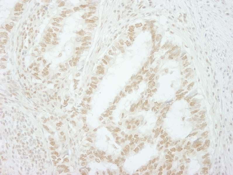 Polyclonal Rabbit anti-Human MKRN2 Antibody (aa366-C-term, IHC)
