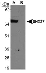 SNX27 Antibody (aa450-500, Biotin)