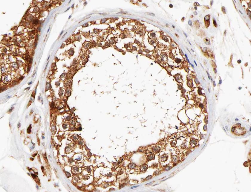 DCLK3 / CLR Antibody