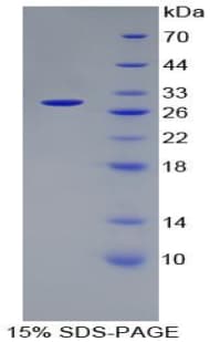 Human ERCC5 / XPG Protein (Recombinant His-T7)