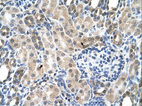 SLC19A1 Antibody (N-Terminus)