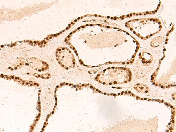 METTL1 Antibody