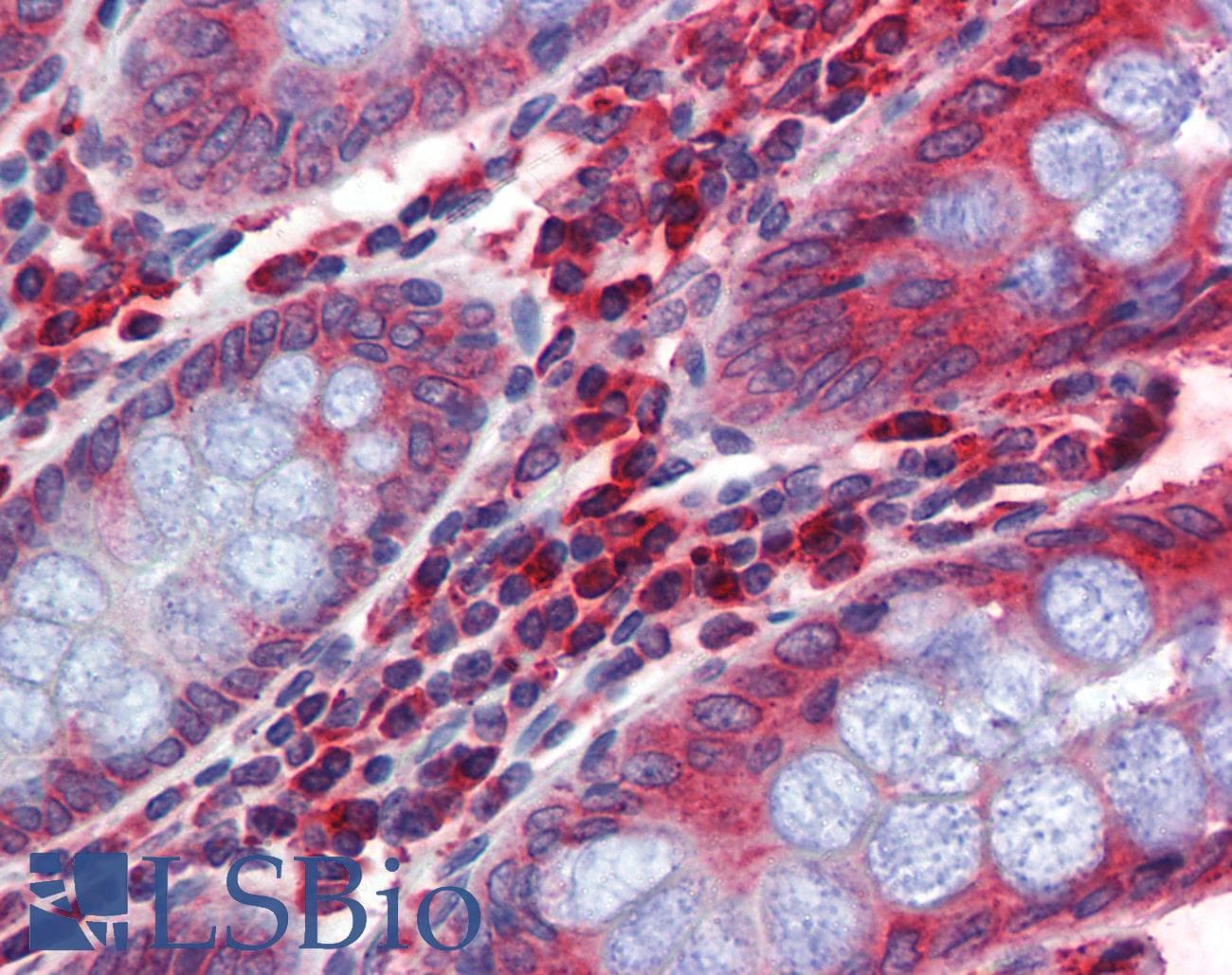 IHC-plus™ Monoclonal Mouse anti-Human EPHB4 / EPH Receptor B4 Antibody (clone 5B5, Extracellular, IHC, IF, WB)