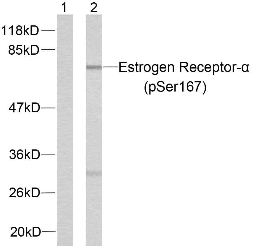 ER Alpha / Estrogen Receptor Antibody (phospho-Ser167)