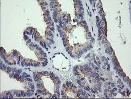 CTAG1B / NY-ESO-1 Antibody (clone OTI2G2, Carrier-free)