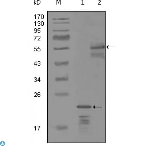 ERBB3 / HER3 Antibody