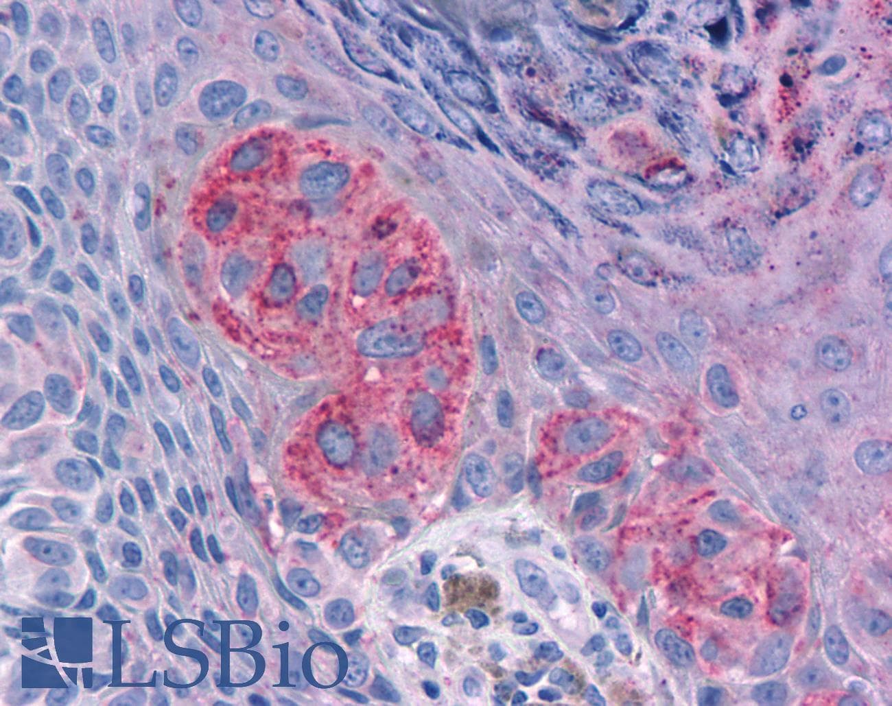 PathPlus™ MRGPRX2 / MRGX2 Antibody (Extracellular Domain)
