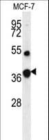 IHC-plus™ FBP1 Antibody (aa125-156)