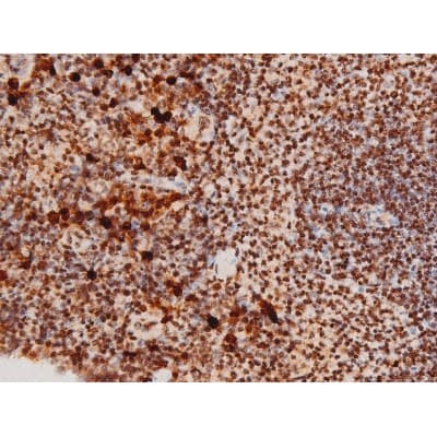 MAPK8 / JNK1 Antibody (phospho-Thr183,pTyr185)