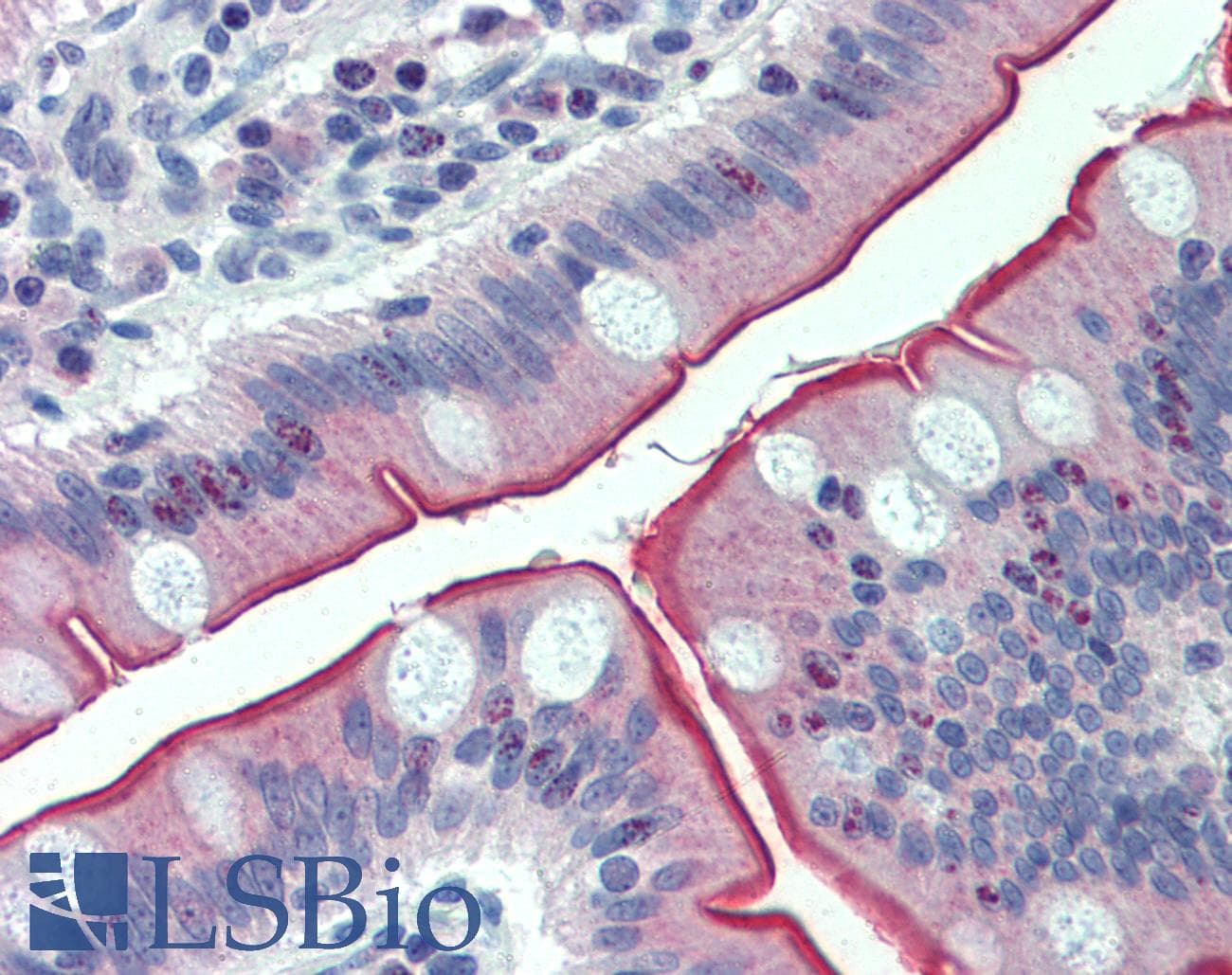 IHC-plus™ CDHR5 / MUCDHL Antibody (Internal)