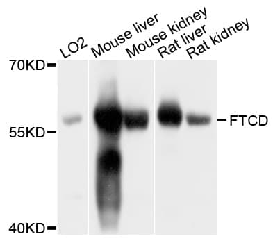 FTCD / 58K Golgi Protein Antibody