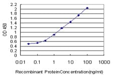 Calgizzarin / S100A11 Antibody (clone 2F4)
