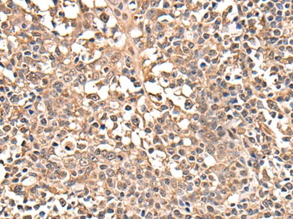 ATRIP Antibody