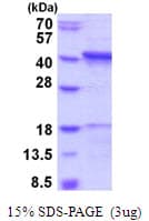 Human CTSL / Cathepsin L Protein (Recombinant His)