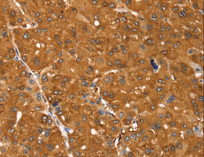 Polyclonal Rabbit anti-Human SSTR3 Antibody (IHC)