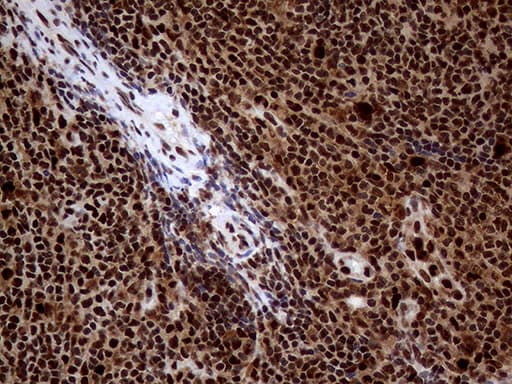 TALDO1 / Transaldolase 1 Antibody (clone OTI1A5, Carrier-free)