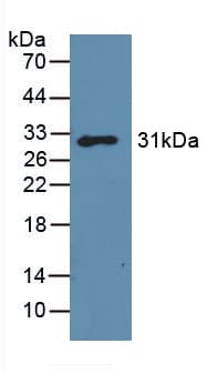 LGALS3 / Galectin 3 Antibody (aa2-264)