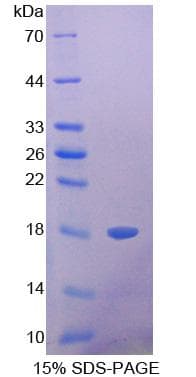 Pig LGALS1 / Galectin 1 Protein (Recombinant His-S)