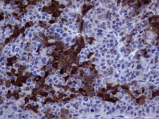 ASS1 / ASS Antibody (C-Terminus, clone OTI3D1)