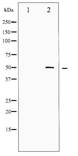 Polyclonal Rabbit anti-Human SRF / Serum Response Factor Antibody (phospho-Ser99, IHC, WB)