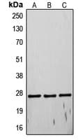 TIMP4 Antibody (C-Terminus)