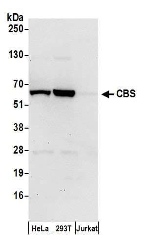 CBS Antibody (aa1-50)