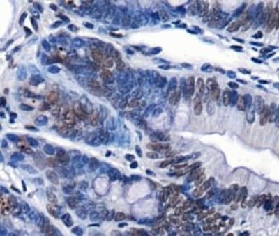 CHD7 Antibody (Biotin)
