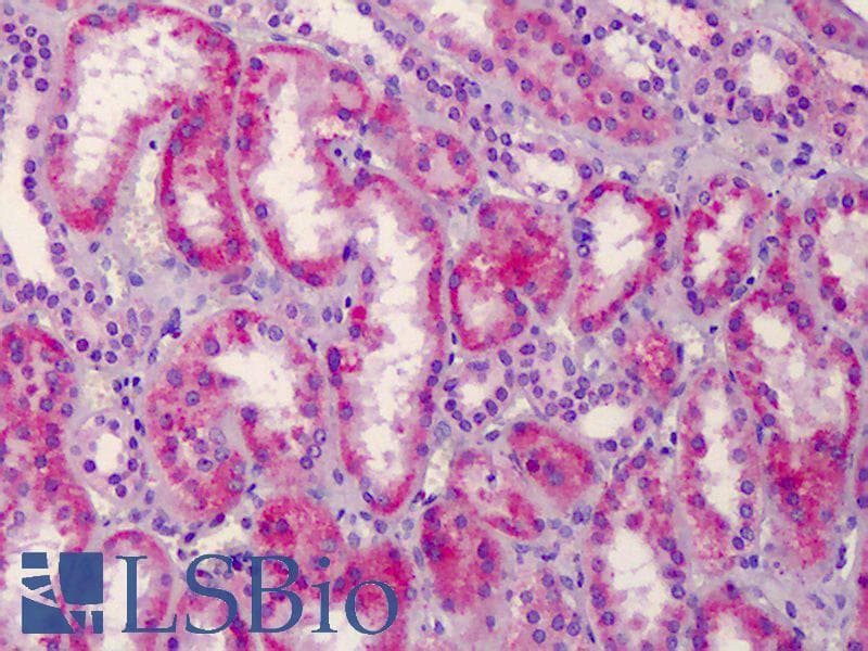 PathPlus™ Polyclonal Rabbit anti-Human HGF / Hepatocyte Growth Factor Antibody (aa521-554, IHC, WB)