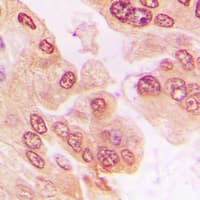 Polyclonal Rabbit anti-Human FOXO1 / FKHR Antibody (phospho-Ser329, IHC, IF, WB)