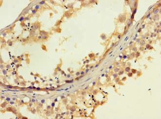 EXD2 Antibody