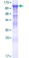 Human KBTBD7 Protein (Recombinant GST)