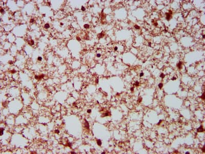 Polyclonal Rabbit anti-Human NEDL2 / HECW2 Antibody (IHC, IF, WB)