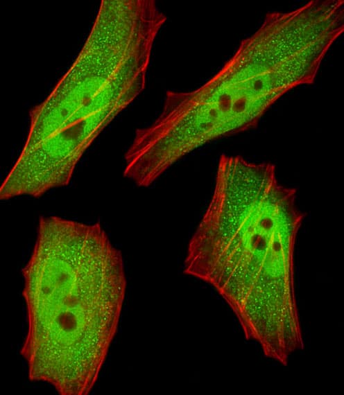 Polyclonal Rabbit anti-Human RBX1 / ROC1 Antibody (aa74-108, IHC, IF, WB)