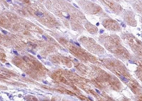 Polyclonal Rabbit anti-Human TNNI3 / Cardiac Troponin I Antibody (phospho-Ser43, IHC, WB)