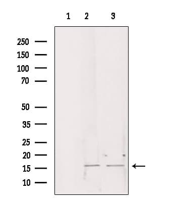 CHCHD2 Antibody