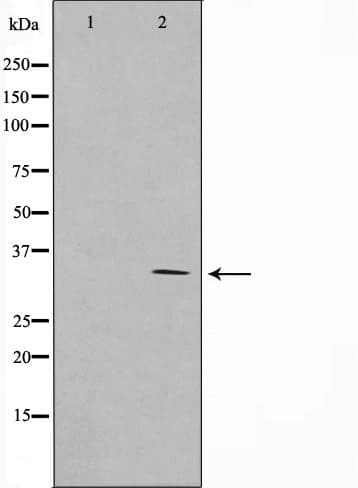 RNF144A / RNF144 Antibody