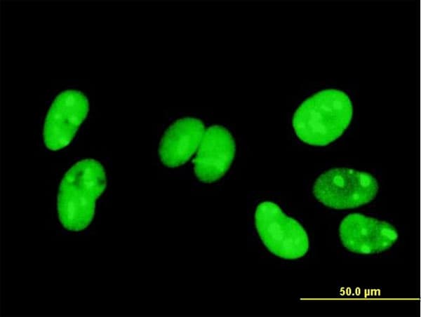 IHC-plus™ HMG1 / HMGB1 Antibody (clone 1B11)