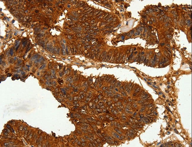 CEACAM21 Antibody