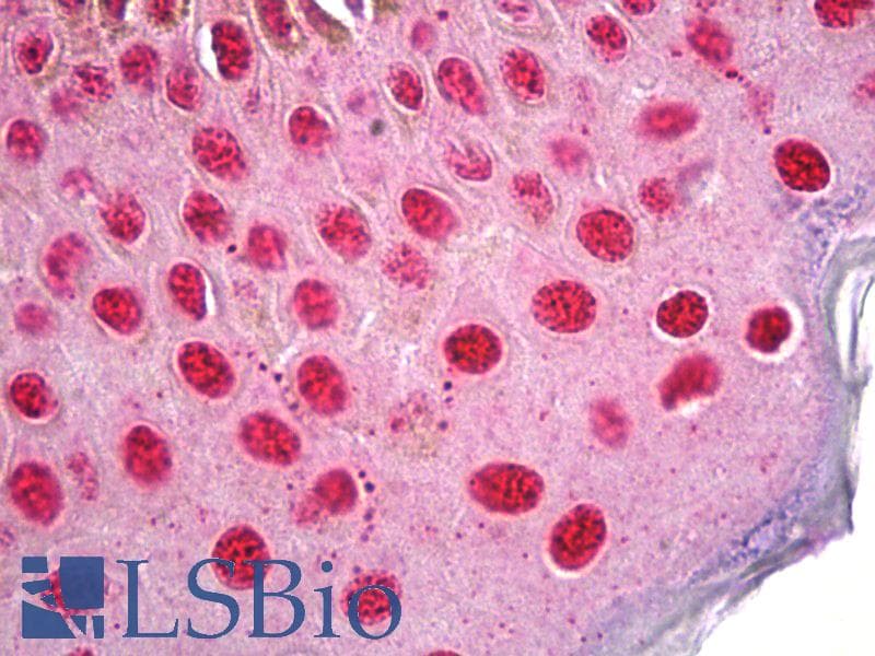 IHC-plus™ Polyclonal Rabbit anti-Human HDAC2 Antibody (aa360-409, IHC, WB)
